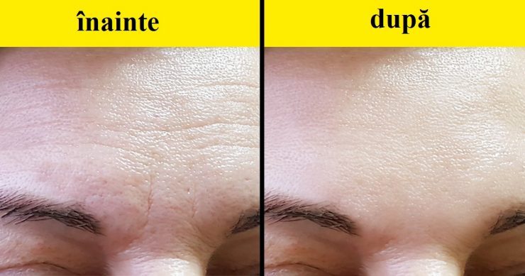 site de vente doccasion suisse anti aging Crema antirid recomandat dermatolog